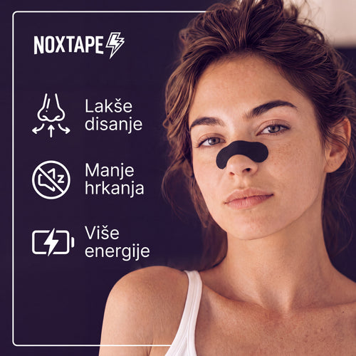 NoxTape Trakice